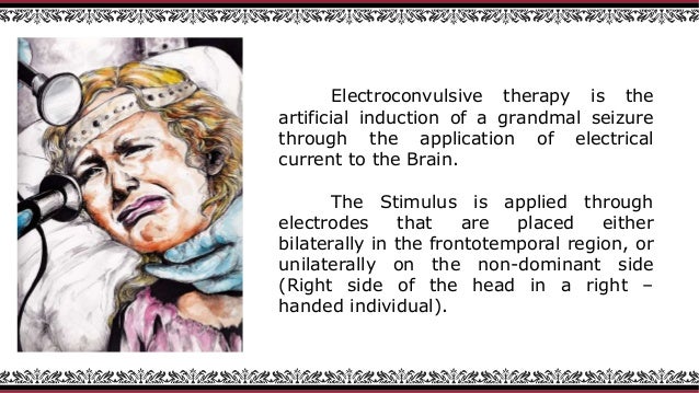 electroshock therapy diagram wiring diagrams control Electroshock Therapy for Depression electroshock therapy diagram wiring diagram shock therapy diagram electroshock therapy diagram
